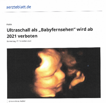 Babyviewing